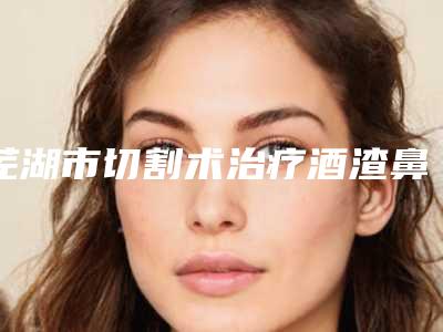 芜湖市切割术治疗酒渣鼻医生上榜名单总结-芜湖市切割术治疗酒渣鼻医生
